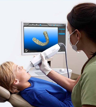 iTero digital mouth scanner